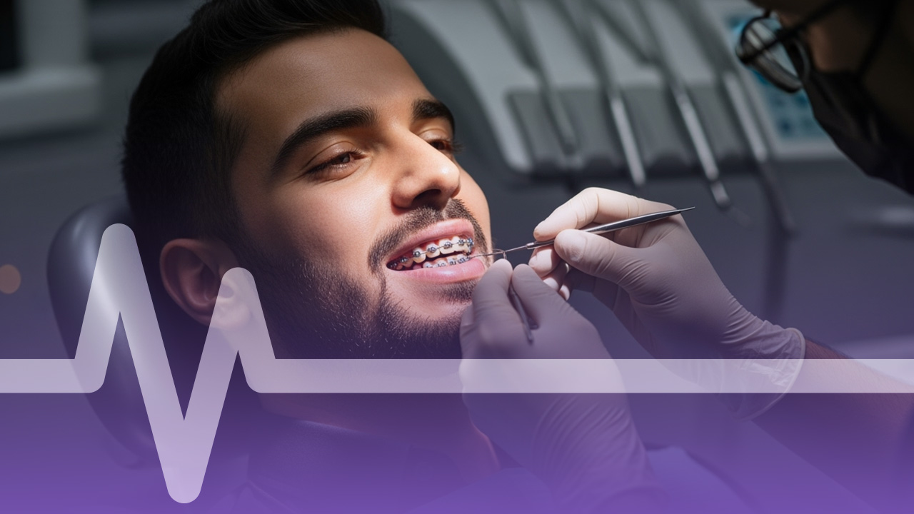 تقويم الأسنان المعدني