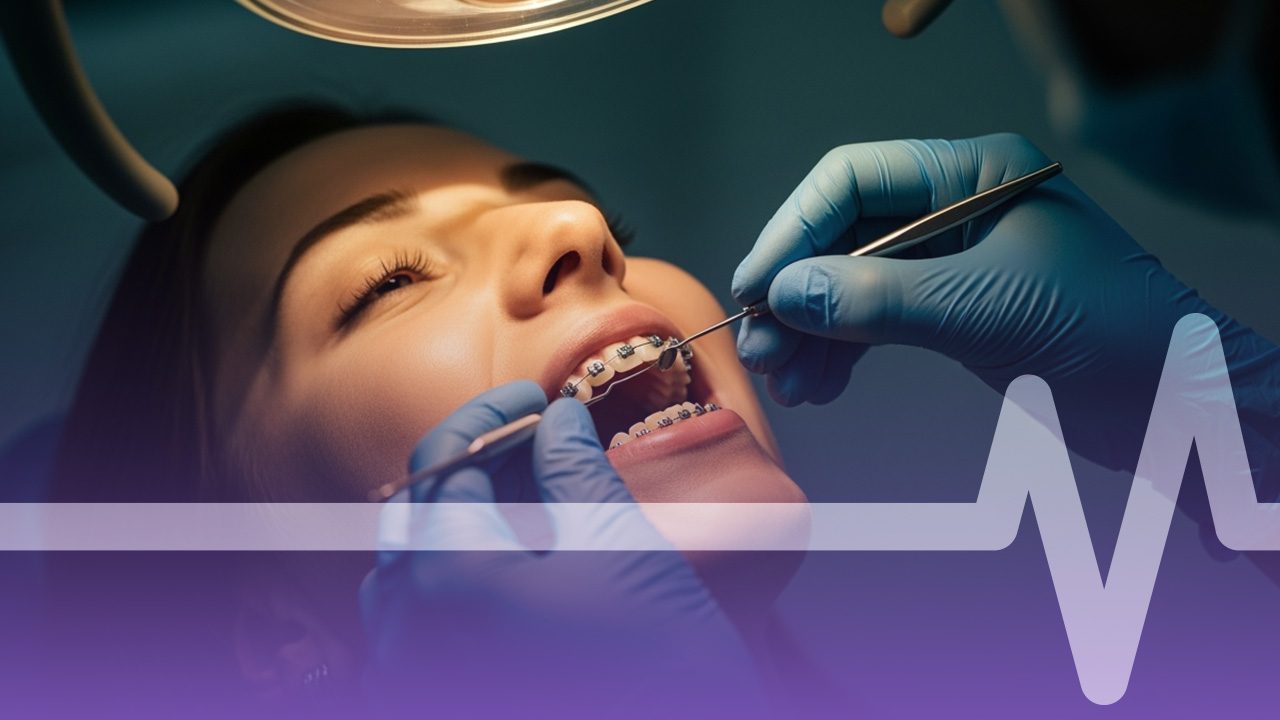 تقويم الأسنان المعدني في الرياض