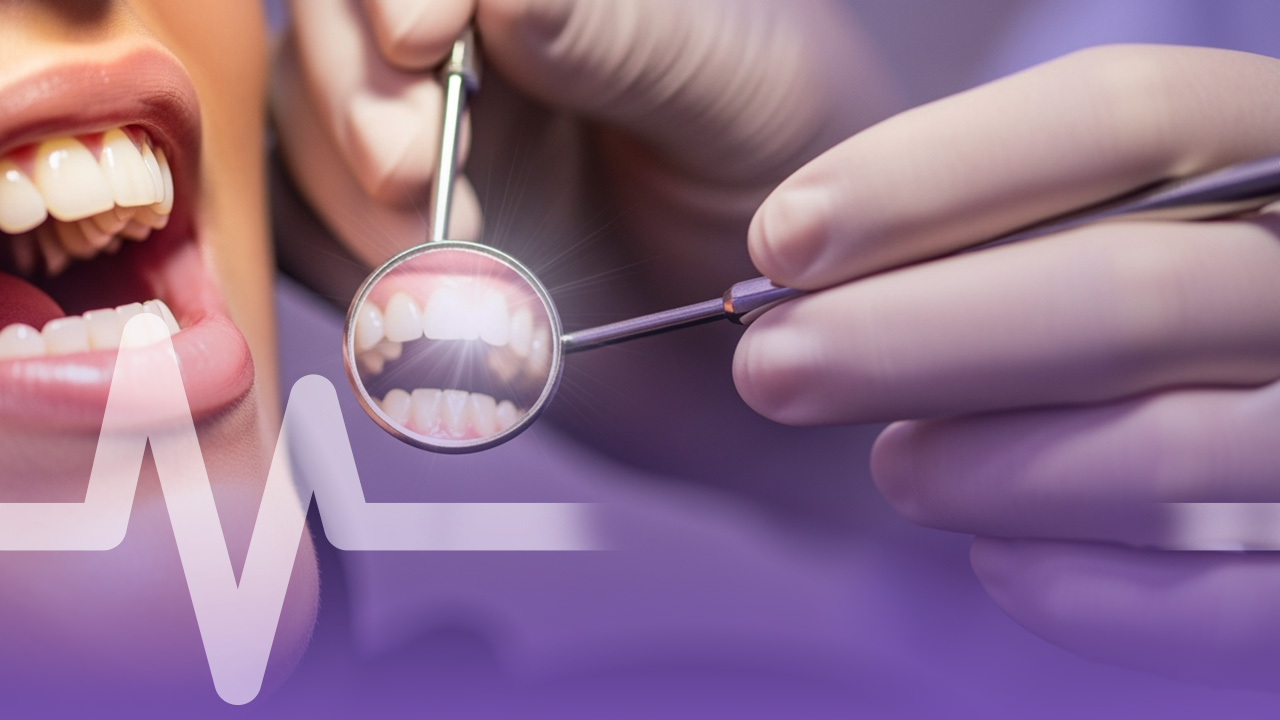 علاج تبييض الأسنان