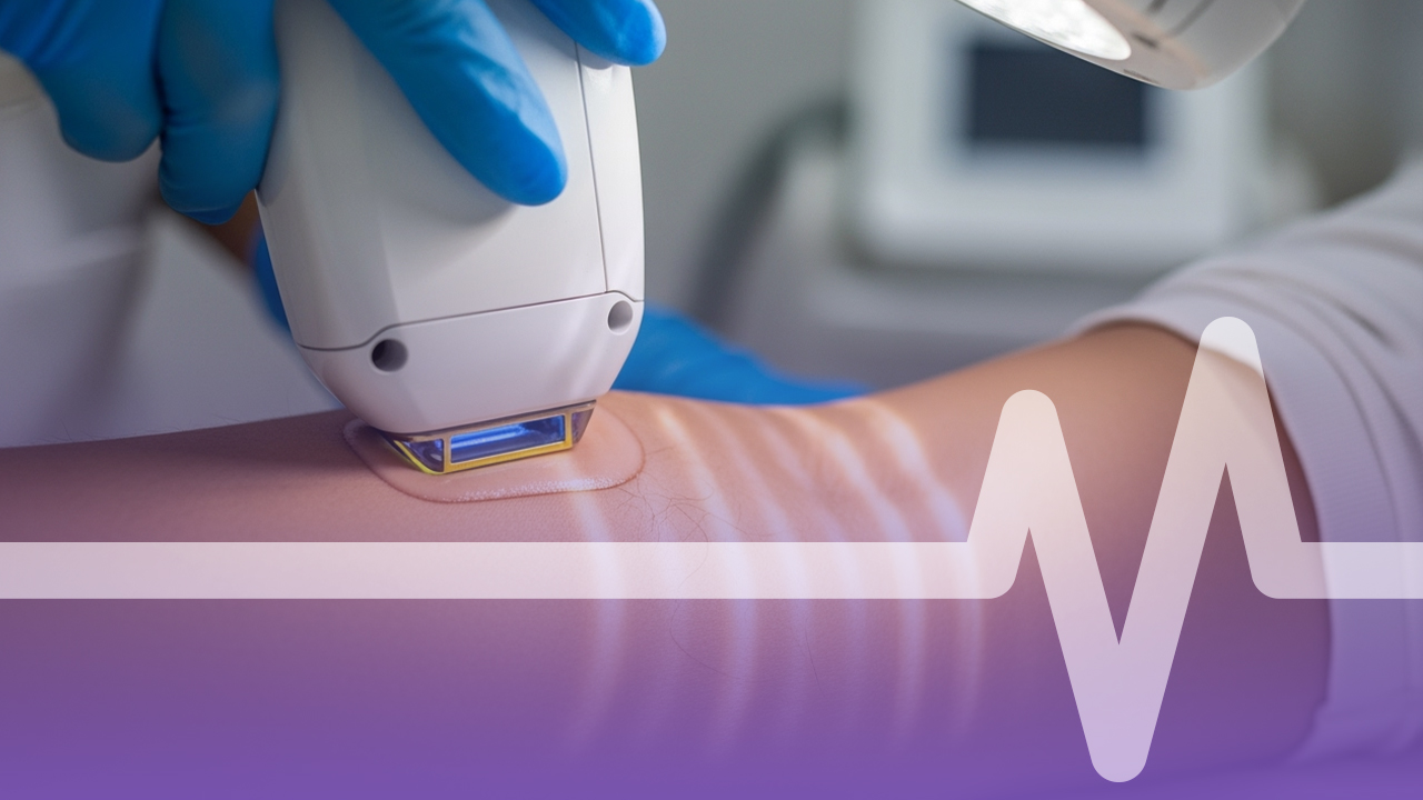  هل سوبرانو ليزر جدة هو الخيار الأفضل لإزالة الشعر بدون ألم؟