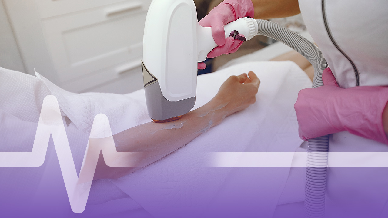 أسباب ظهور الشعر بعد الليزر بكثافة