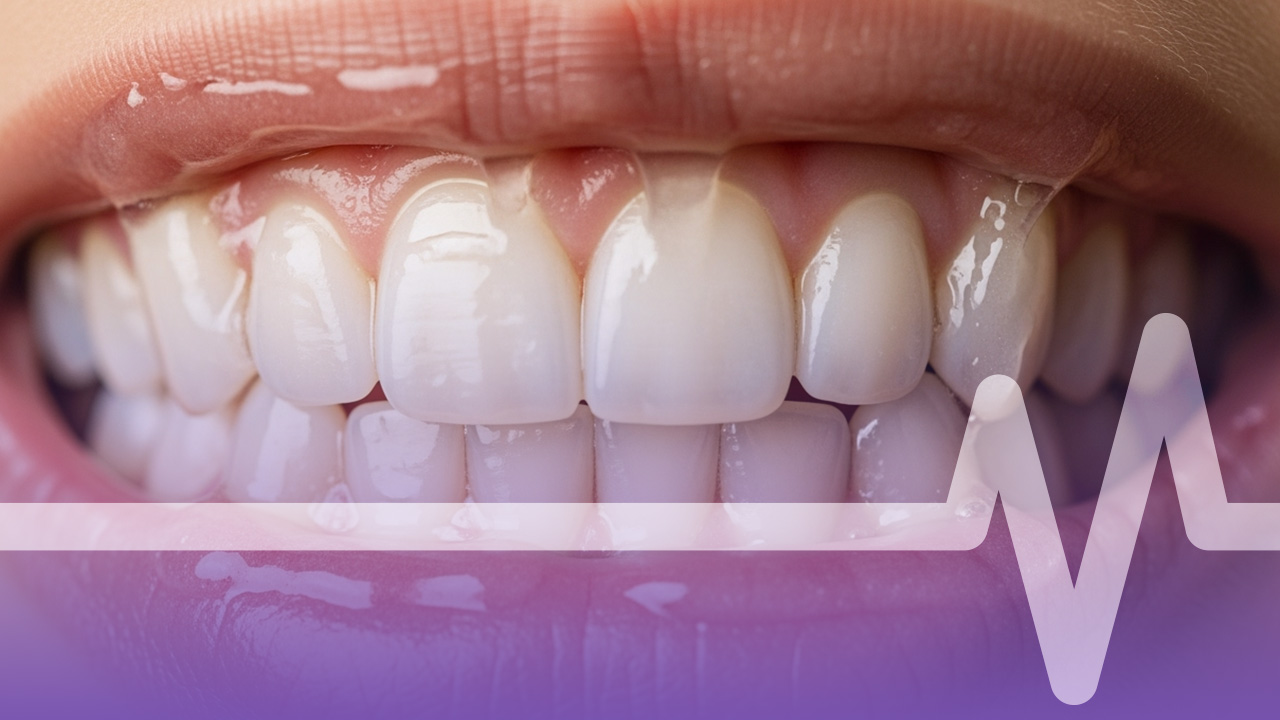 تبييض الأسنان هابي سمايل