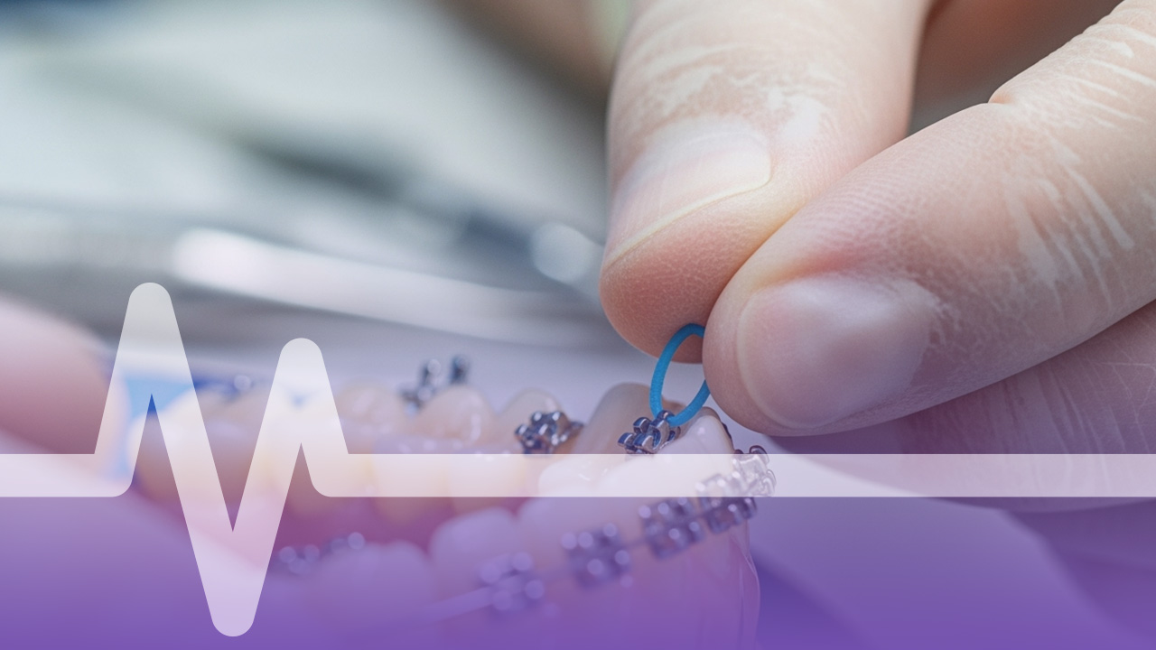 اسعار التقويم الشفاف في السعودية