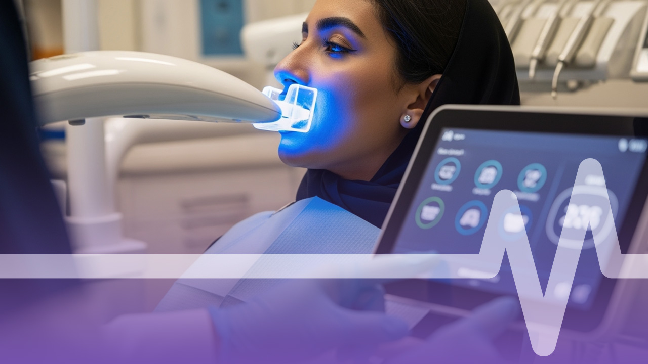 قوالب تبييض الأسنان المنزلية